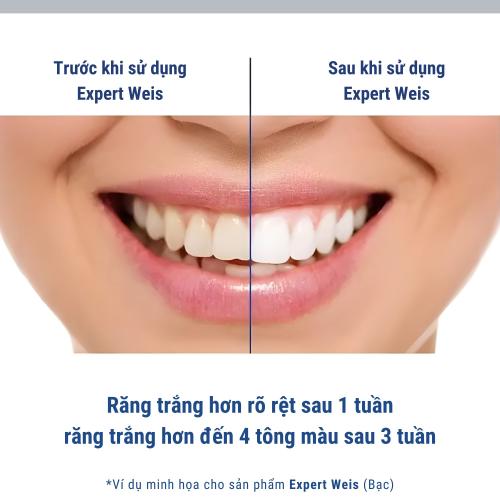 Kem đánh răng SIÊU TRẮNG PERL WEISS