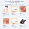 Sét Dụng Cụ Nặn Mụn JPNK Pro SK201 - Công Cụ Xử Lý Khuyết Điểm Da Chuẩn Y Khoa
